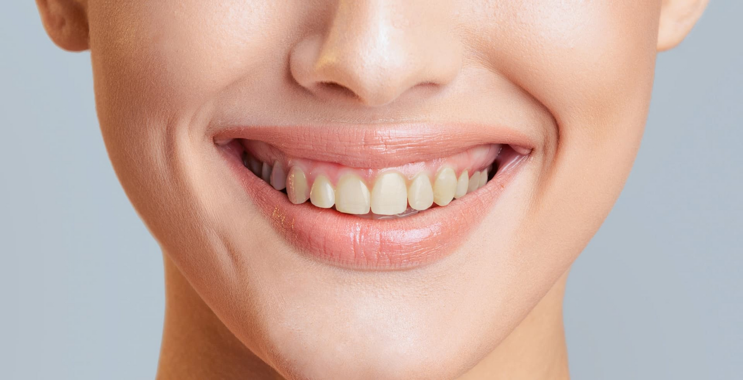 image comparison before